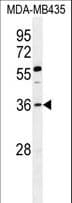 Polyclonal Rabbit anti-Human FOXE3 Antibody (aa87-114, WB)