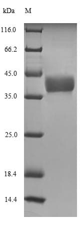 Xenopus laevis H1F0 Protein (Recombinant 6His-SUMO, N-terminus)