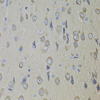 SMO / Smoothened Antibody