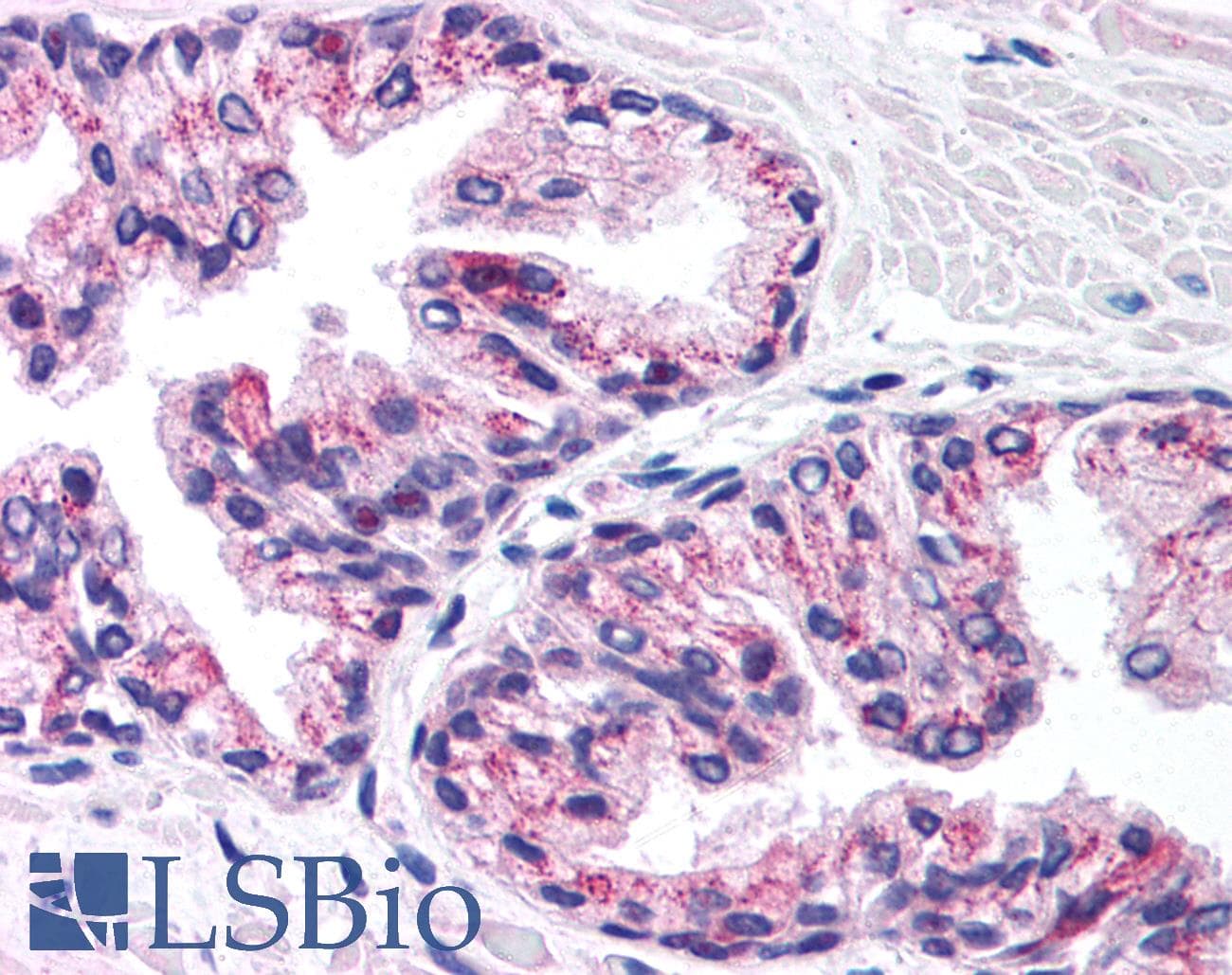 PHKG2 Antibody (N-Terminus)