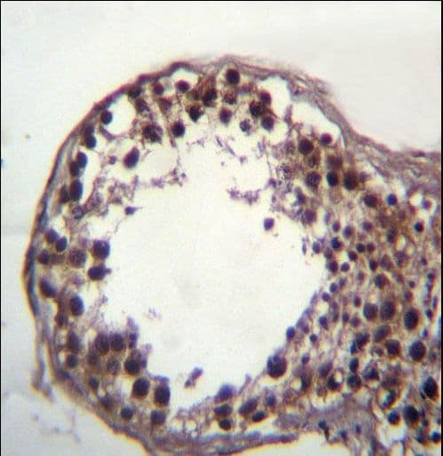 DAZ3 Antibody (aa445-474)