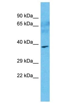 SOCS7 / SOCS-7 Antibody (aa3-52)