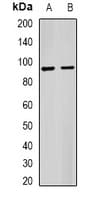 Polyclonal Rabbit anti-Human IL1RAP Antibody (WB)