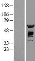 AKT2 Protein (Over-Expression Lysate Myc-DDK (Flag))