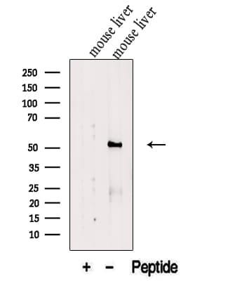 Polyclonal Rabbit anti-Human FTCD / 58K Golgi Protein Antibody (WB)