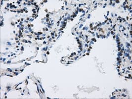 Monoclonal Mouse anti-Human DCXR Antibody (clone OTI7D11, IHC, WB)