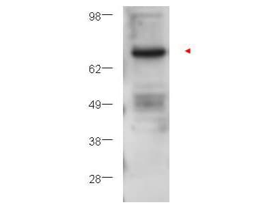 PRKCB / PKC-Beta Antibody