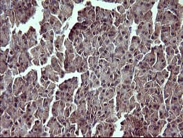 TP73 / p73 Antibody (aa167-409, clone OTI1B5)