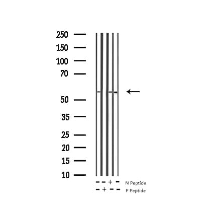 TH / Tyrosine Hydroxylase Antibody (phospho-Ser40)