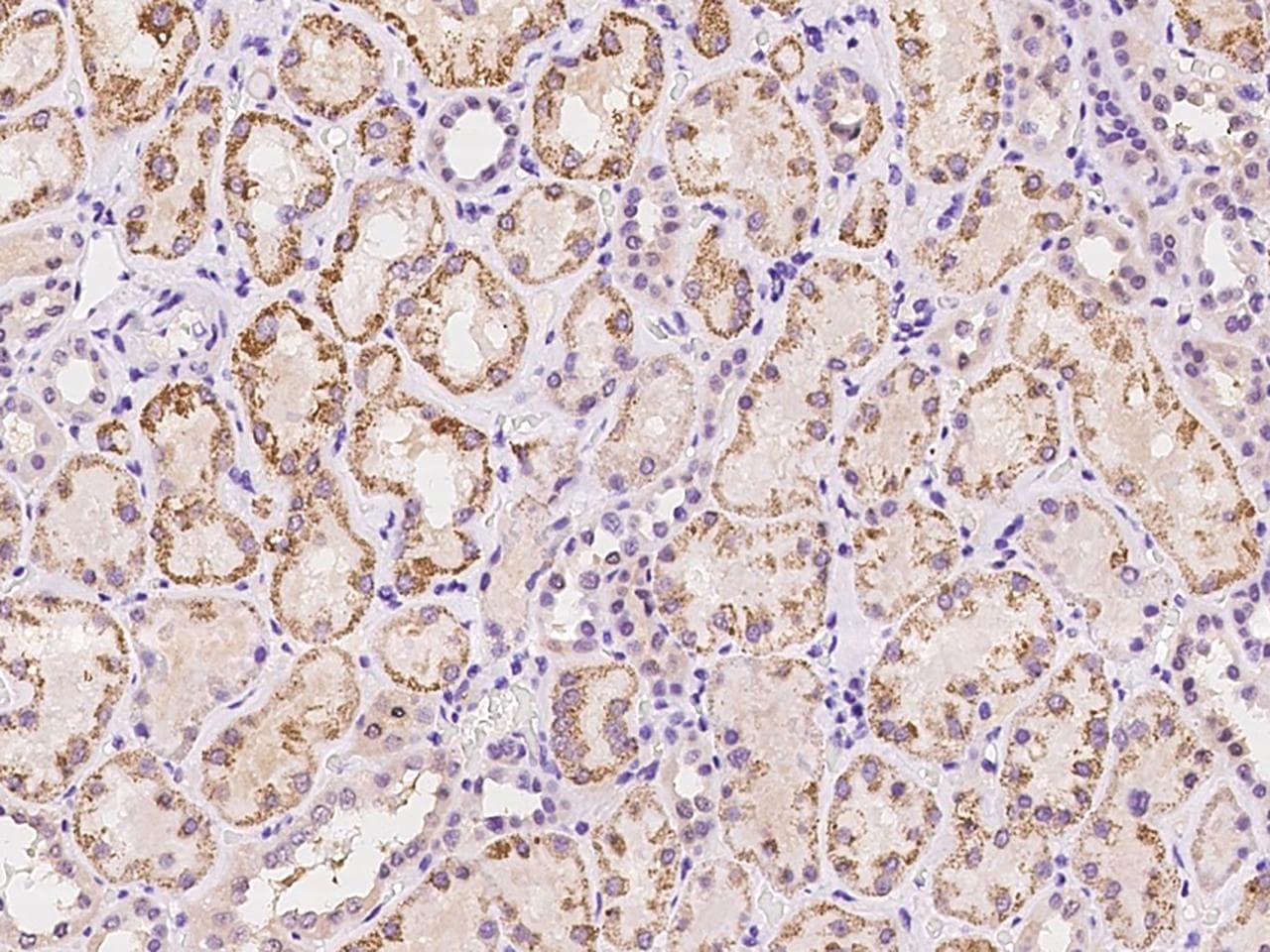Polyclonal Rabbit anti-Human SLC19A3 Antibody (IHC)