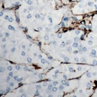 Endostatin Antibody (Internal)
