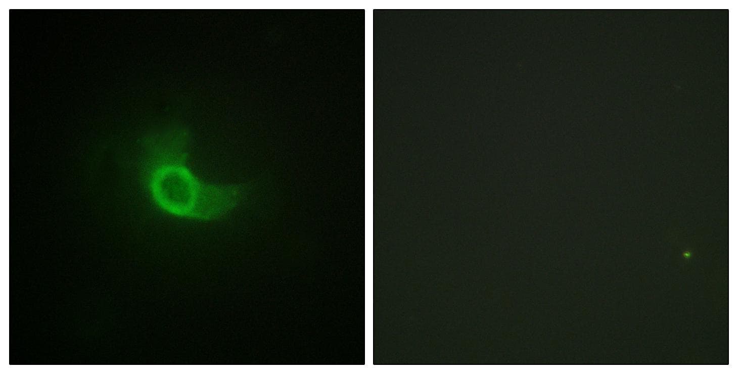 Polyclonal Rabbit anti-Human IL6ST / CD130 / gp130 Antibody (p782, IHC, IF, WB)