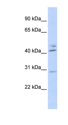 Polyclonal Rabbit anti-Human SPIC Antibody (N-Terminus, WB)