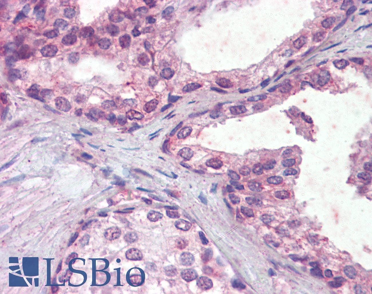 IHC-plus™ IFNAR2 Antibody (Internal Region)