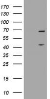 METTL16 / METT10D Antibody (clone OTI5F10)
