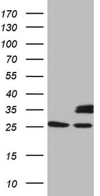 SDHB Antibody (clone OTI1H6)