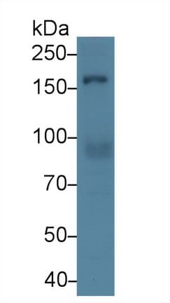 Rho Kinase / ROCK1 Antibody (aa1094-1323)