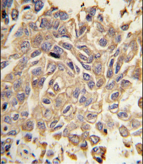RYK Antibody (aa160-190)