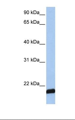 ARF6 Antibody (C-Terminus)