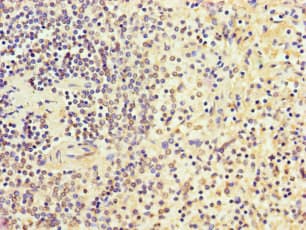 CCDC101 Antibody
