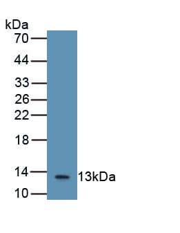 B2M / Beta 2 Microglobulin Antibody