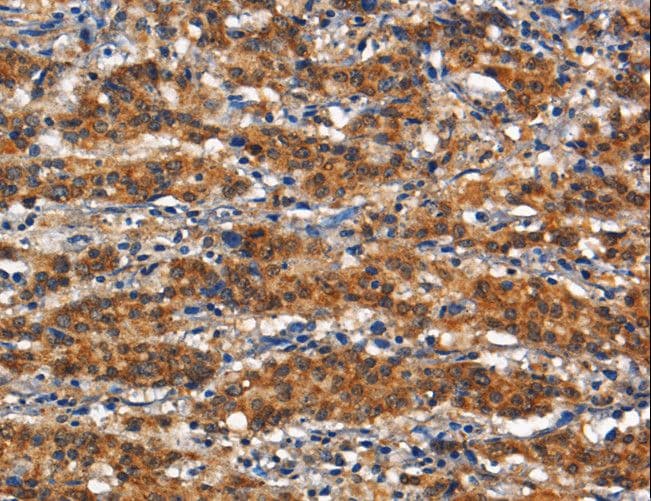 ANPEP / CD13 Antibody