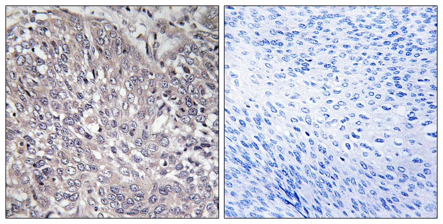 ITPR1 / IP3 Receptor Type 1 Antibody