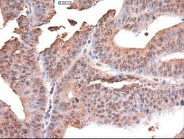 MYC / c-Myc Antibody (clone OTI3F2)