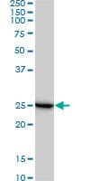 RPL19 / Ribosomal Protein L19 Antibody (clone 3H4)