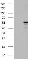TP53 / p53 Antibody (clone OTI2H6, Carrier-free)
