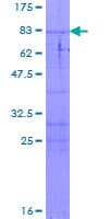 Human BLMH Protein (Recombinant GST)