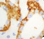 Monoclonal Mouse anti-Human CDH16 / Cadherin 16 Antibody (clone 4H6/F9, Ready-to-Use, IHC)