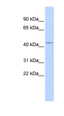 ACP2 / Acid Phosphatase 2 Antibody (aa144-193)