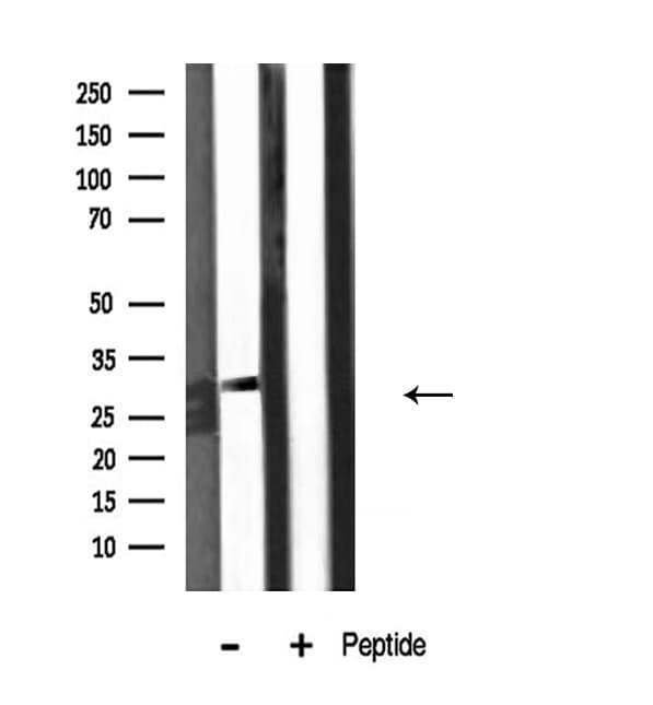 KCNMB2 Antibody