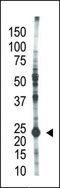 UBE2S / E2 EPF Antibody (aa10-40)