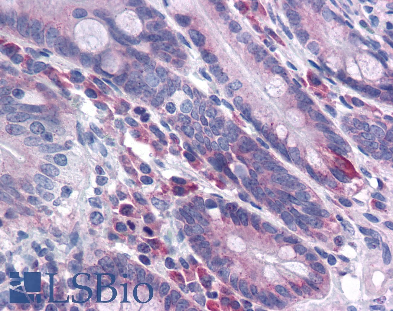 IHC-plus™ Polyclonal Rabbit anti-Human DISP2 Antibody (IHC)