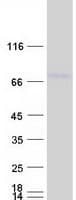Human DCP1B Protein (Recombinant Myc-DDK (Flag))