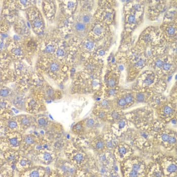 Polyclonal Rabbit anti-Human CYP2C18 / CYP2C Antibody (IHC, WB)