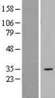 SLC25A34 Protein (Over-Expression Lysate Myc-DDK (Flag))