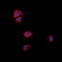 OXER1 Antibody (Internal)