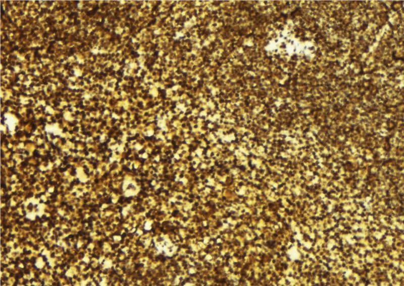 CAMKK2 Antibody