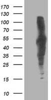 DLD / Diaphorase / E3 Antibody (clone OTI6D5)