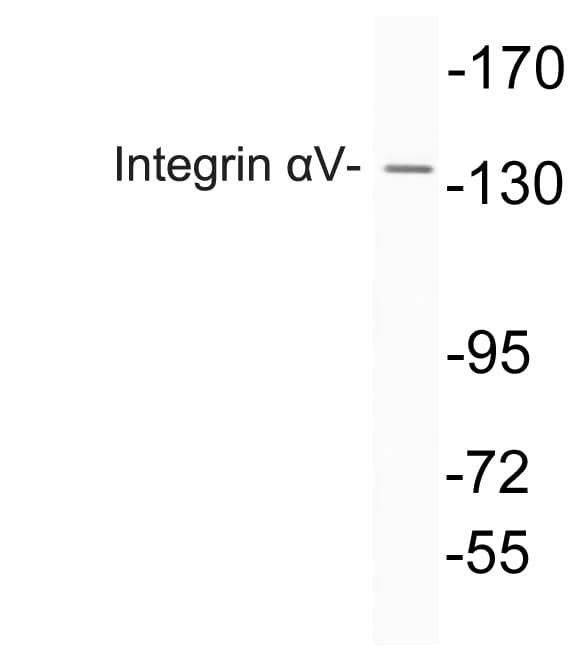 IHC-plus™ ITGAV/Integrin Alpha V/CD51 Antibody (aa755-804)