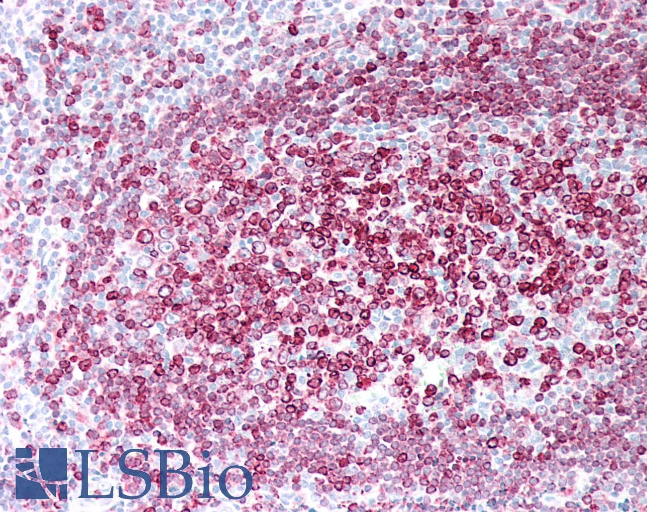 PathPlus™ Monoclonal Mouse anti-Human CD74 / CLIP Antibody (IHC)