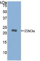 MMP12 Antibody (aa290-469)
