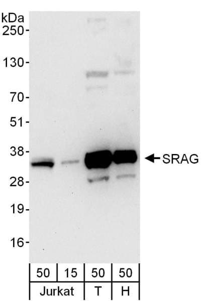 CHTOP / FOP Antibody (aa1-50)