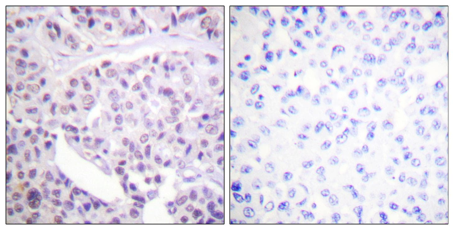 Polyclonal Rabbit anti-Human TP53 / p53 Antibody (p392, IHC, IF, WB)
