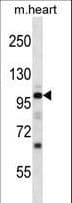 NPRA / NPR1 Antibody (aa198-226)