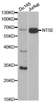 IHC-plus™ Polyclonal Rabbit anti-Human NT5E / eNT / CD73 Antibody (IHC, IF, WB)