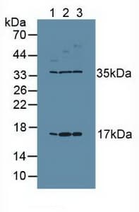 MKI67 / Ki67 Antibody (aa3088-3235, PE)